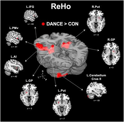 Trait representation of embodied cognition in dancers pivoting on the extended mirror neuron system: a resting-state fMRI study